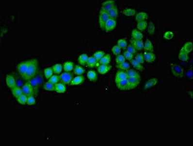 MAGEA8 Antibody
