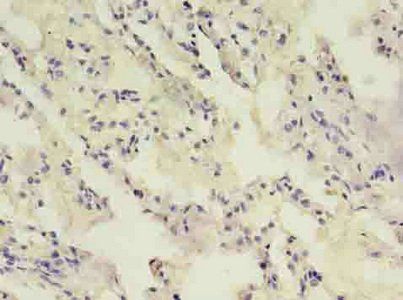 MAGEA8 Antibody