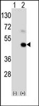 MAGEA9 antibody