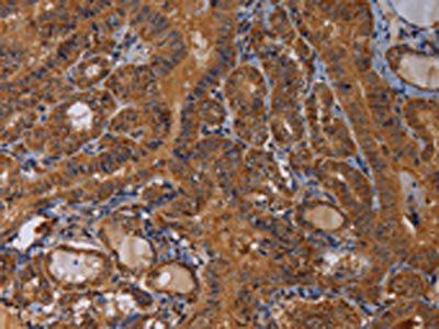 MAGEB10 antibody