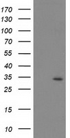MAGEB18 Antibody