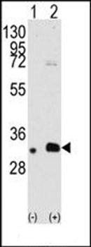 MAGEB2 antibody
