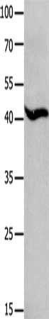 MAGEB4 Antibody