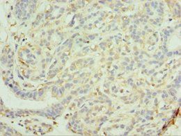 MAGEC2 antibody