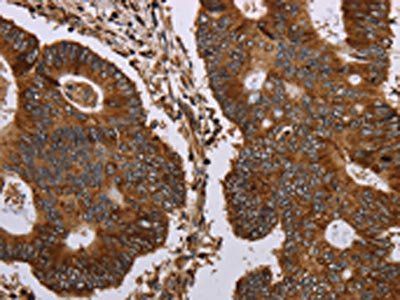 MAGEC2 Antibody