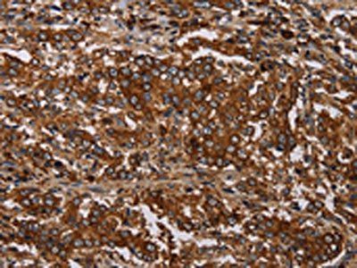 MAGEC2 Antibody