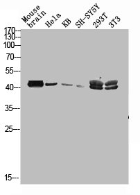 MAGEC2 Antibody