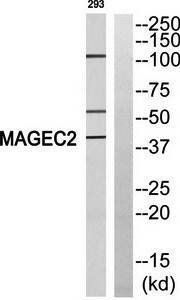 MAGEC2 antibody