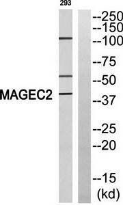 MAGEC2 Antibody