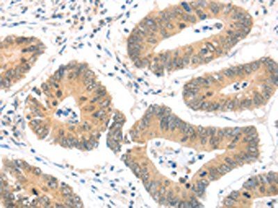 MAGED1 Antibody