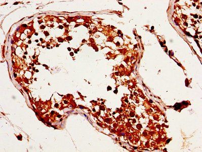 MAGED2 Antibody