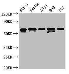 MAGED2 antibody