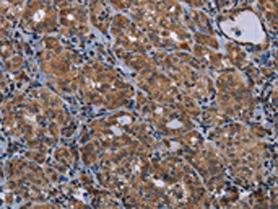MAGEE1 Antibody