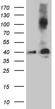 MAK Antibody