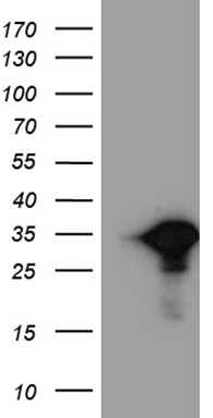MAK Antibody