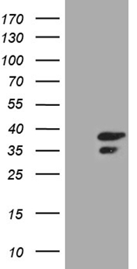 MAK Antibody