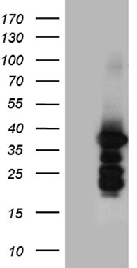 MAK Antibody
