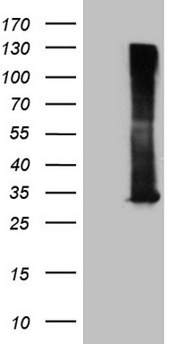 MAK Antibody