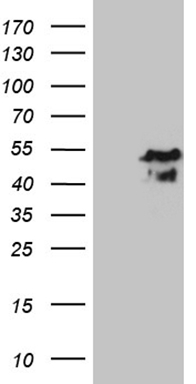 MAK Antibody