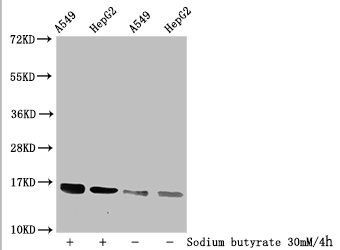 Malonyl-HIST1H3A (K56) Antibody