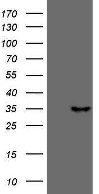 MALT1 Antibody
