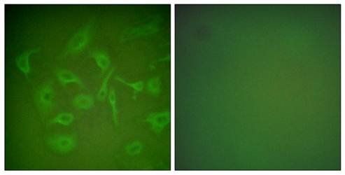 Mammaglobin Antibody