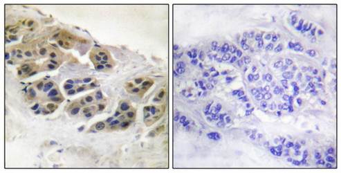 Mammaglobin Antibody