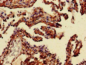 MAN2A1 Antibody