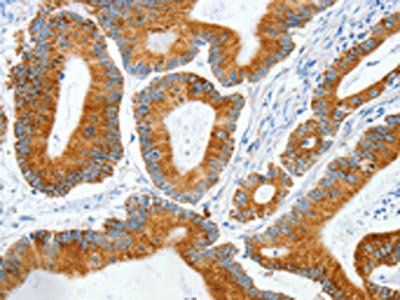 MANF antibody