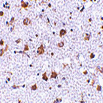 MANF Rabbit Polyclonal Antibody