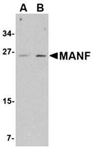 MANF Rabbit Polyclonal Antibody