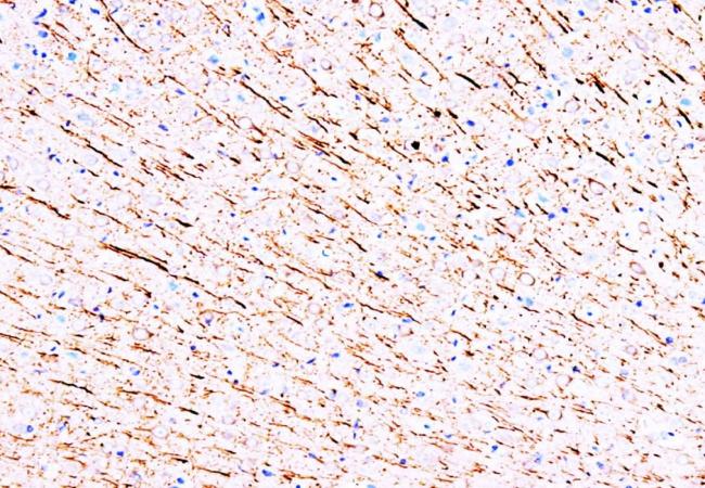 MAP1 Mouse Monoclonal Antibody