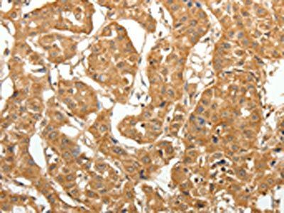 MAP1B Antibody