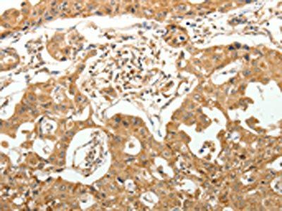 MAP1B Antibody