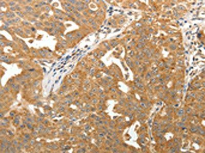 MAP1B Antibody
