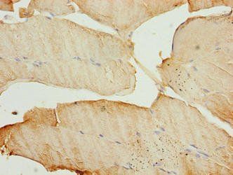 MAP1LC3A Antibody