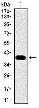 MAP1LC3B Antibody