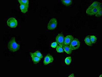 MAP1LC3C antibody