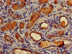 MAP1LC3C Antibody