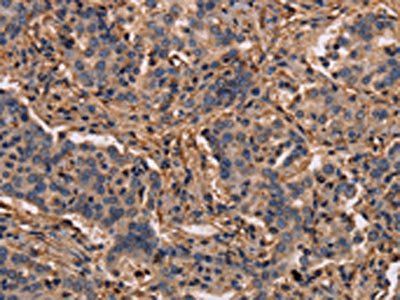MAP1LC3C Antibody