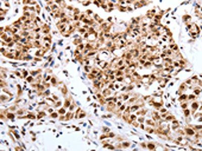 Map2 Antibody