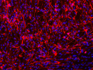 MAP2 Antibody