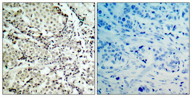 MAP2K3 (Ab-189) Antibody