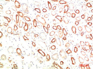 MAP2K3 Antibody