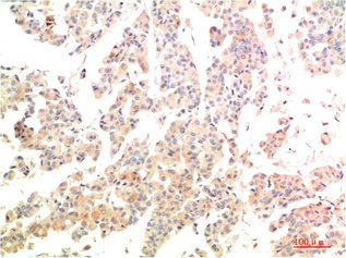 MAP2K3 Antibody