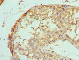 MAP2K5 Antibody