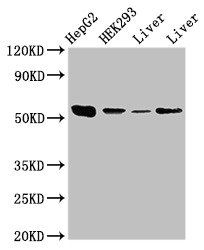 MAP2K5 Antibody