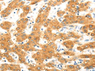 MAP2K6 Antibody