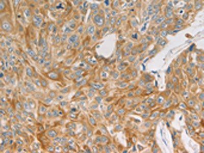 MAP2K6 Antibody