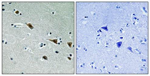 MAP2K7 (phospho-Ser271) antibody